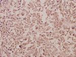 RAB5C Antibody in Immunohistochemistry (Paraffin) (IHC (P))