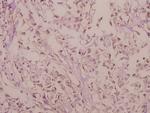 RhoG Antibody in Immunohistochemistry (Paraffin) (IHC (P))