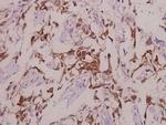 Phospho-ADD1/ADD2 (Ser726, Ser713) Antibody in Immunohistochemistry (Paraffin) (IHC (P))