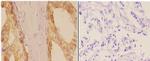 Phospho-ADD1/ADD2 (Ser726, Ser713) Antibody in Immunohistochemistry (Paraffin) (IHC (P))