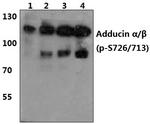 Phospho-ADD1/ADD2 (Ser726, Ser713) Antibody in Western Blot (WB)