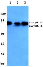 Phospho-ADD1/ADD2 (Ser726, Ser713) Antibody in Western Blot (WB)