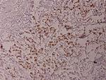 Phospho-ATF2 (Thr69) Antibody in Immunohistochemistry (Paraffin) (IHC (P))