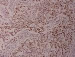 Phospho-ATF2 (Thr73) Antibody in Immunohistochemistry (Paraffin) (IHC (P))