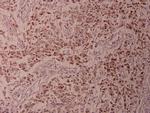 Phospho-ATF2 (Thr73) Antibody in Immunohistochemistry (Paraffin) (IHC (P))