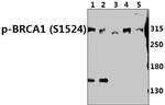 Phospho-BRCA1 (Ser1524) Antibody in Western Blot (WB)