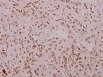 Phospho-Cyclin E (Thr395) Antibody in Immunohistochemistry (Paraffin) (IHC (P))