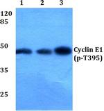 Phospho-Cyclin E (Thr395) Antibody in Western Blot (WB)