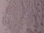 Phospho-Fyn (Tyr530) Antibody in Immunohistochemistry (Paraffin) (IHC (P))