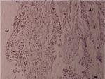 Phospho-Fyn (Tyr530) Antibody in Immunohistochemistry (Paraffin) (IHC (P))