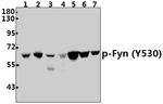 Phospho-Fyn (Tyr530) Antibody in Western Blot (WB)