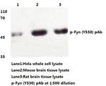 Phospho-Fyn (Tyr530) Antibody in Western Blot (WB)