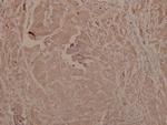 Phospho-GSK3 alpha/beta (Tyr279, Tyr216) Antibody in Immunohistochemistry (Paraffin) (IHC (P))