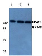 Phospho-HDAC5 (Ser498) Antibody in Western Blot (WB)