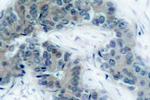 Phospho-JAK2 (Tyr1007) Antibody in Immunohistochemistry (Paraffin) (IHC (P))