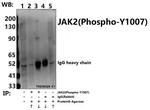 Phospho-JAK2 (Tyr1007) Antibody in Immunoprecipitation (IP)