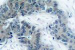 Phospho-JAK2 (Tyr1007) Antibody in Immunohistochemistry (Paraffin) (IHC (P))