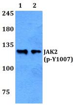 Phospho-JAK2 (Tyr1007) Antibody in Western Blot (WB)