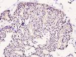 Phospho-LIMK1 (Thr508) Antibody in Immunohistochemistry (Paraffin) (IHC (P))