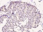 Phospho-LIMK1 (Thr508) Antibody in Immunohistochemistry (Paraffin) (IHC (P))