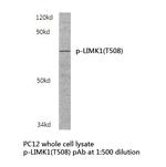 Phospho-LIMK1 (Thr508) Antibody in Western Blot (WB)