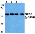 Phospho-MEF2A (Ser408) Antibody in Western Blot (WB)