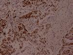 Phospho-MEF2A (Thr312) Antibody in Immunohistochemistry (Paraffin) (IHC (P))