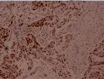 Phospho-MEF2A (Thr312) Antibody in Immunohistochemistry (Paraffin) (IHC (P))