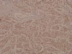 Phospho-MEF2A (Thr319) Antibody in Immunohistochemistry (Paraffin) (IHC (P))