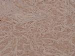 Phospho-MEF2A (Thr319) Antibody in Immunohistochemistry (Paraffin) (IHC (P))