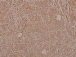 Phospho-MEK3 (Ser189) Antibody in Immunohistochemistry (Paraffin) (IHC (P))