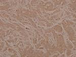 Phospho-MEK6 (Ser207) Antibody in Immunohistochemistry (Paraffin) (IHC (P))