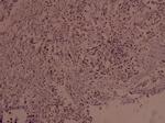 Phospho-c-Myc (Ser373) Antibody in Immunohistochemistry (Paraffin) (IHC (P))