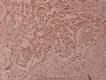 Phospho-NFkB p100 (Ser866) Antibody in Immunohistochemistry (Paraffin) (IHC (P))