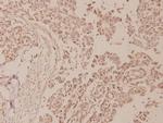 Phospho-NFkB p100 (Ser870) Antibody in Immunohistochemistry (Paraffin) (IHC (P))