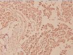 Phospho-NFkB p100 (Ser870) Antibody in Immunohistochemistry (Paraffin) (IHC (P))