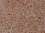 Phospho-SHP-1 (Tyr536) Antibody in Immunohistochemistry (Paraffin) (IHC (P))