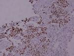 Phospho-STAT5 alpha (Ser780) Antibody in Immunohistochemistry (Paraffin) (IHC (P))