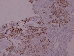 Phospho-STAT5 alpha (Ser780) Antibody in Immunohistochemistry (Paraffin) (IHC (P))