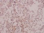 Phospho-TrkB (Tyr516) Antibody in Immunohistochemistry (Paraffin) (IHC (P))