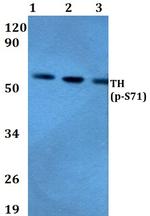 Phospho-Tyrosine Hydroxylase (Ser71) Antibody in Western Blot (WB)