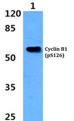 Phospho-Cyclin B1 (Ser126) Antibody in Western Blot (WB)