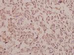 Phospho-IKK alpha/beta (Ser180, Ser181) Antibody in Immunohistochemistry (Paraffin) (IHC (P))