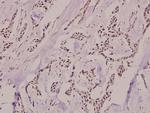 Phospho-Ku80 (Thr714) Antibody in Immunohistochemistry (Paraffin) (IHC (P))