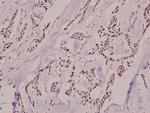 Phospho-Ku80 (Thr714) Antibody in Immunohistochemistry (Paraffin) (IHC (P))