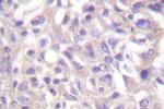 Phospho-alpha Adducin (Thr445) Antibody in Immunohistochemistry (Paraffin) (IHC (P))