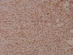 Phospho-INSR (Tyr1355) Antibody in Immunohistochemistry (Paraffin) (IHC (P))