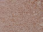 Phospho-INSR (Tyr1355) Antibody in Immunohistochemistry (Paraffin) (IHC (P))