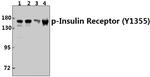 Phospho-INSR (Tyr1355) Antibody in Western Blot (WB)