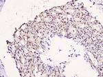 Phospho-IRS1 (Ser323) Antibody in Immunohistochemistry (Paraffin) (IHC (P))